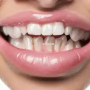 哪些牙膏可以有效去除龋齿斑点并保护牙齿免受进一步损害？